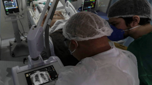 Naukowcy odkryli, co sprawia, że niektórzy ciężko przechodzą zarażenie COVID-19