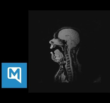 Człowiek śpiewający podczas rezonansu magnetycznego!